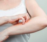 לימפומה של העור: עדיף טיפול משולב -תמונה